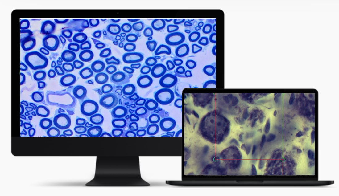 Neuropath computer use