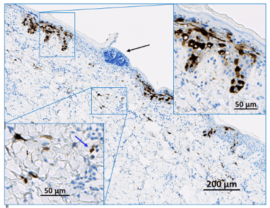 A pig skin injection site showing local expression of a reporter molecule, which is then detected with an anti-reporter molecule antibody