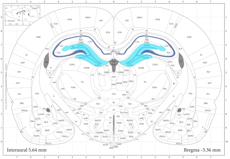 Figure 2 coronal brain section.jpg