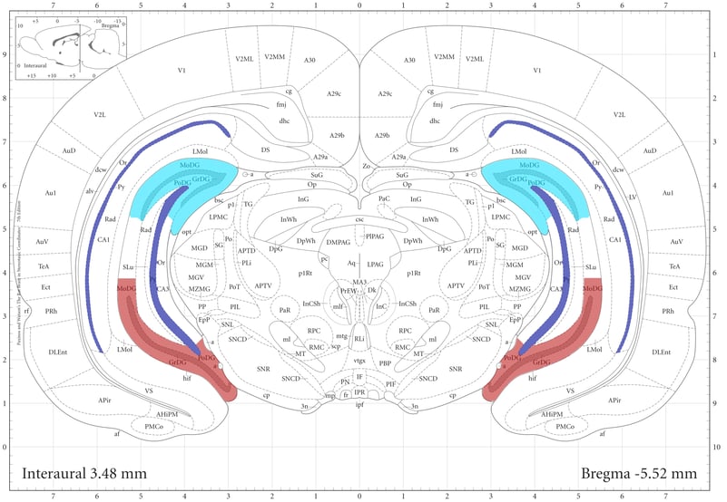 Figure 3 coronal brain section.jpg