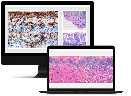 Pathology