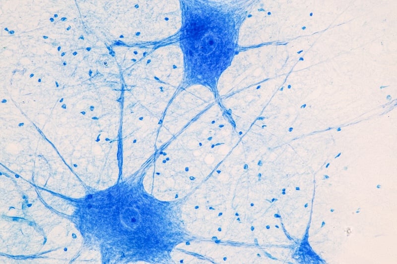 Spinal cord and Motor Neuron under the microscope