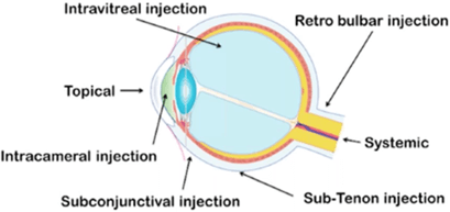 ocular2