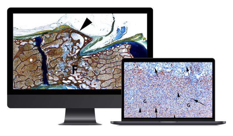 The evaluation of myofibroblasts underneath a microscope displayed on computer screen