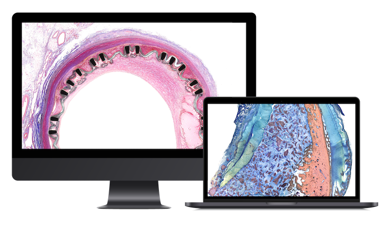 The evaluation of proximal cell underneath a microscope displayed on computer screen